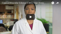 Cystoid Macular Edema (CME): Injection